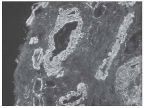 C53-FF27.gif | Abdominal Key 