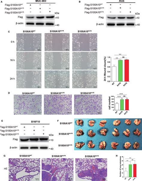 Succinylation Mimetic S A K E Mutant Enhances Cancer Cell Invasion