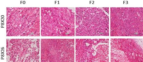 Comparison Of Histopathologic Findings Between Patients And Their