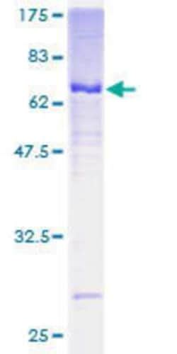 Novus Biologicals Recombinant Human Centaurin Alpha 2 GST N Term