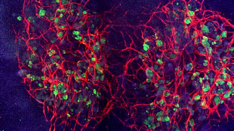 The Role Of Vascularization In Organoid Advancements Qkine