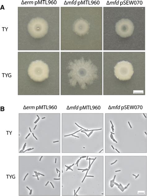 Colony And Cellular Morphology Of The C Difficile Mfd Mutant A Liquid