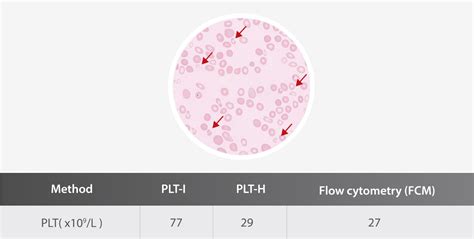 Hemabook Chapter 18 Plt H A New Parameter For Accurate Platelet