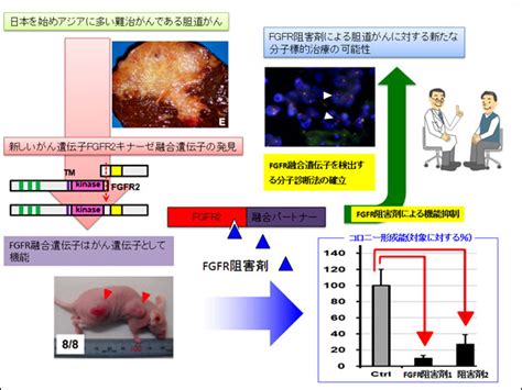 胆道がん（肝内胆管がん）の治療標的となる新たながん遺伝子を発見、さらにその遺伝子の働きを阻害する薬剤｜国立がん研究センター