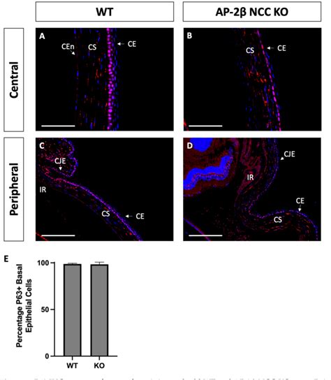 Figure 1 from Conditional Deletion of AP 2β in the Periocular