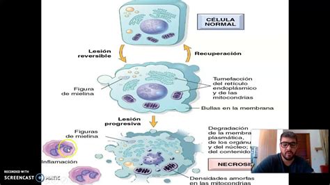 Lesi N Y Muerte Celular Youtube