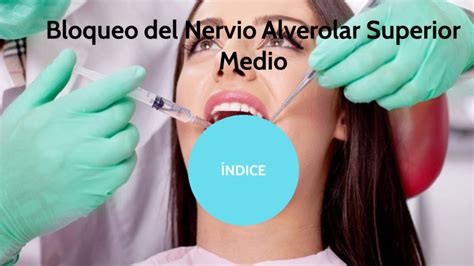 Bloqueo Del Nervio Alveolar Superior Medio By Brenda Gonzalez On Prezi