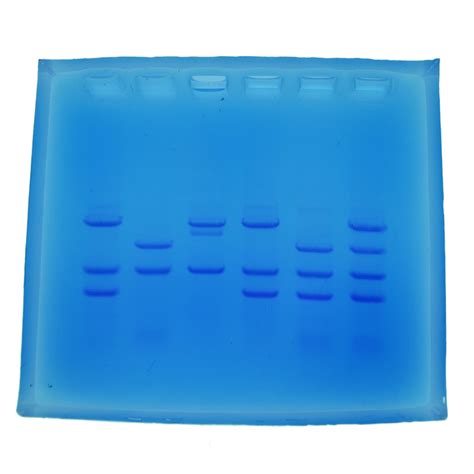 Gel Electrophoresis DNA Fingerprinting