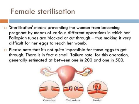 Ppt Contraceptives Powerpoint Presentation Free Download Id 2357383