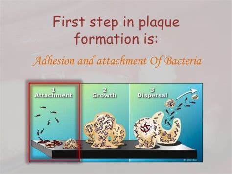 Dental plaque formation