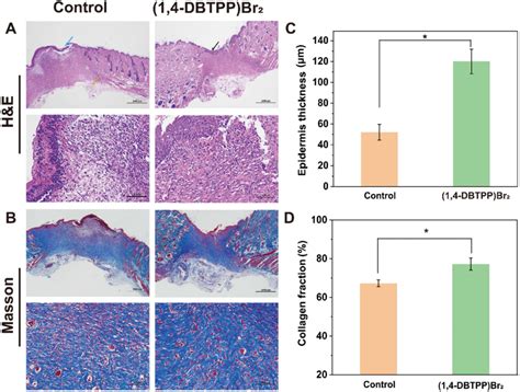 A Hematoxylin Eosin Hande Staining And B Massons Trichrome Mt