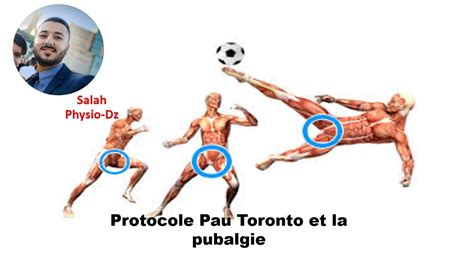 Un Protocole Efficace Pour La Pubalgie YouTube