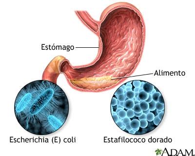 Intoxicaci N Alimentaria Medlineplus Enciclopedia M Dica