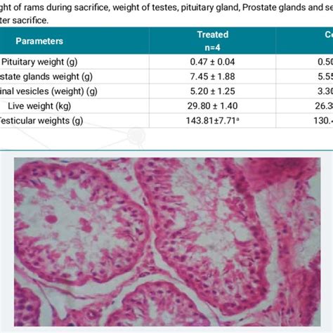 Photomicrograph Of Testis Of Control Group Seminiferous Tubules With