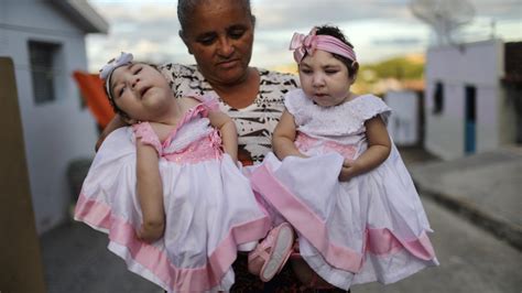 Zika-affected babies show severe health issues two years later