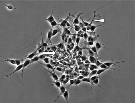 Sh Sy Y Cell Line Culture Protocol And Research Applications