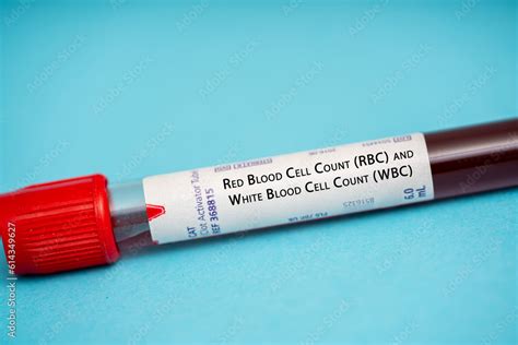 Red Blood Cell Count Rbc And White Blood Cell Count Wbc Test Stock