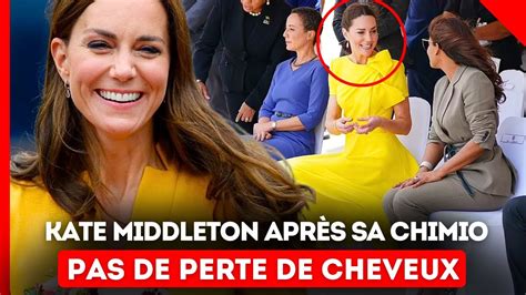 Kate Middleton Apr S Sa Chimio Pas De Perte De Cheveux Son M Decin