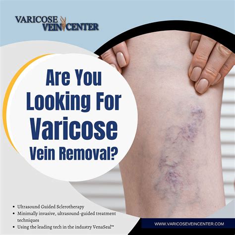 Vein Treatment Clinic — Port Jefferson Ny By Varicose Vein Center Medium