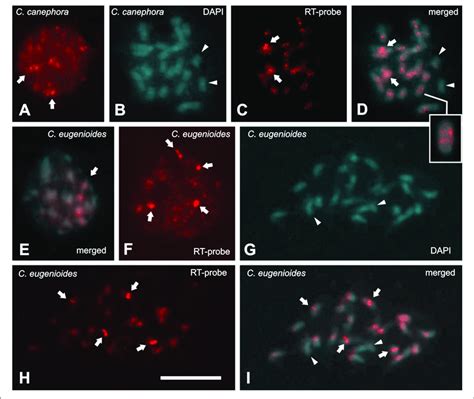 Fluorescence In Situ Hybridization Fish In Nucleus And Metaphases