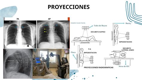 Rx Torax Para Interpretaci N De Radiograf A Pptx