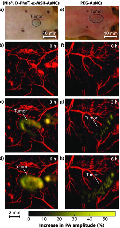 Nude Mice Transplanted With Melanomas A Before Injection Of