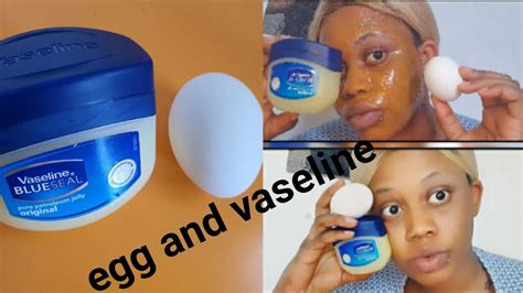 How To Smoothen And Lighten Your Face With Egg And Vaseline Youtube