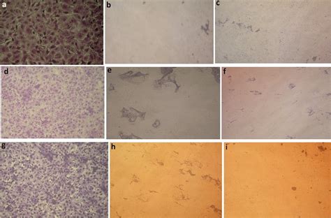 Morphological Changes In HepG 2 Cells Incubated For 24 H A Negative