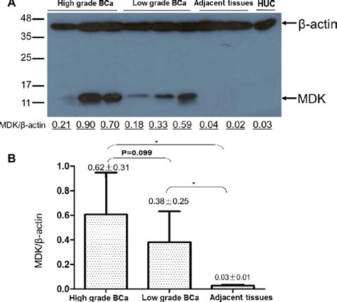 A MDK Protein Was High In Bca Tissues And Low In The Adjacent Tissues