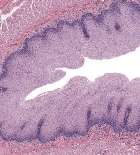 Bios Upper Digestive System Post Lab Histology Flashcards Quizlet