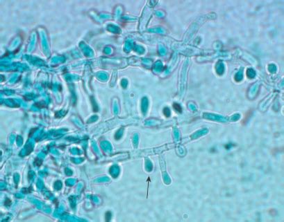 Pathogenic Microbiology Exam 3 Flashcards | Quizlet