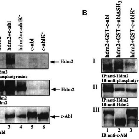 C Abl Phosphorylates Hdm In Vivo A Cells Were Transfected