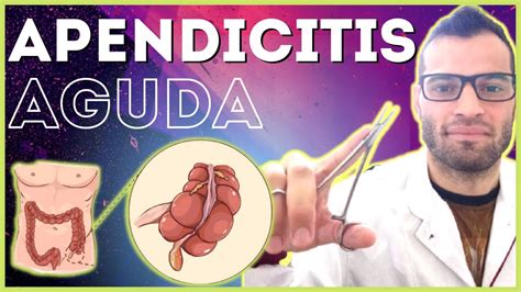 Apendicitis Aguda Abdomen Agudo Inflamatorio Youtube Sexiz Pix