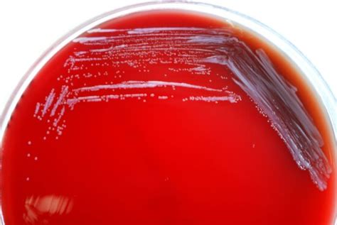 Free Picture Brucella Abortus Bacteria Blood Agar