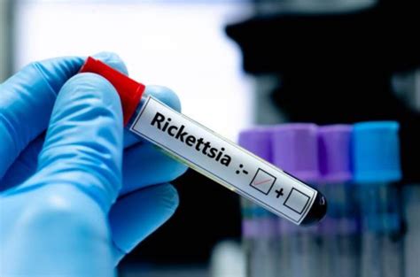 Alertan Por Rickettsia En Mexico Que Es Como Se Contagia Y Sintomas