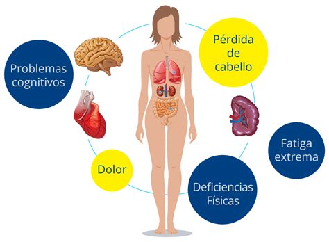 Infograf A Lupus Eurofarma