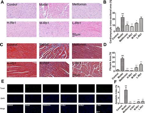 Ginsenoside Rb Protects Against Diabetic Cardiomyopathy Jir