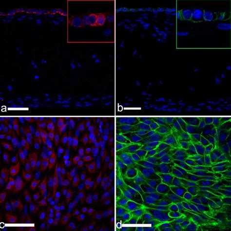 Extracellular matrix component type III collagen in subepithelial... | Download Scientific Diagram