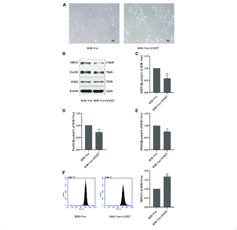 Ex527 Inhibited Verapamil Induced Sirt1 Signaling Stimulation And The