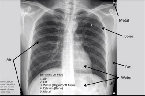 Radiology Quiz 1 Flashcards Quizlet