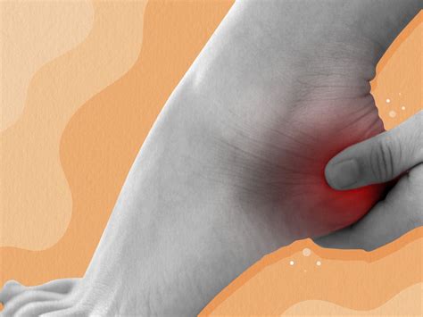 Heel Bursitis Causes And Treatment Treat My Achilles 41 Off