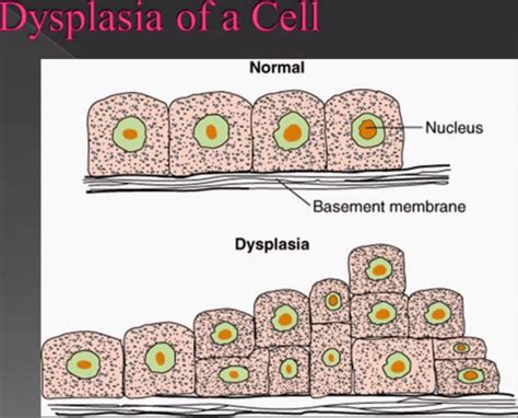 Cell Injury and Adaptations Flashcards | Quizlet