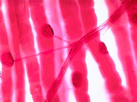 neuromuscular junction