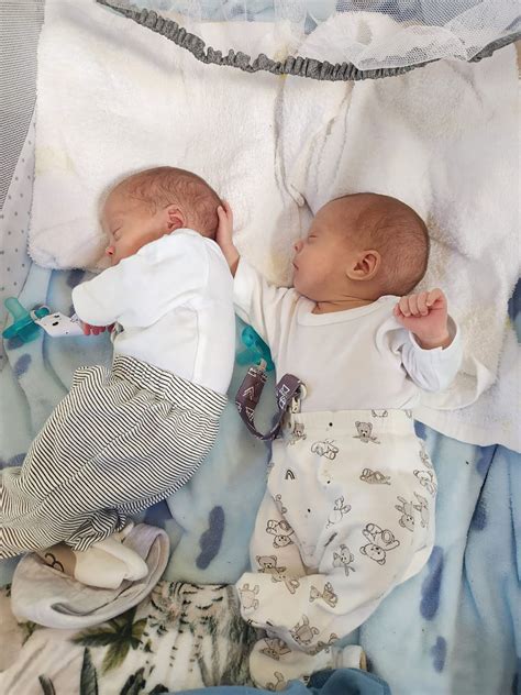 Against All Odds: Twins Reunited After Life-Saving Surgery