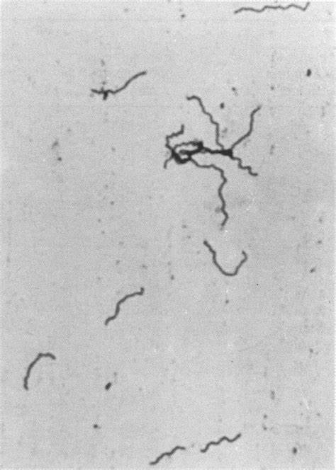 Spirochetes Gram Stain