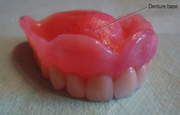 Parts of Complete Denture | Dr. Nechupadam Dental Clinic