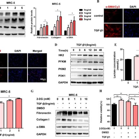 Glycolysis plays a key role in TGF β1 induced pulmonary fibroblast