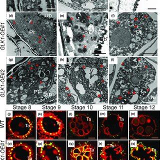 Transmission Electron Microscopy TEM And Terminal Deoxynucleotidyl