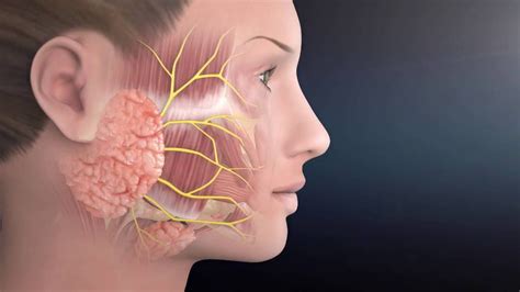 Parotid Gland Tumor Removal