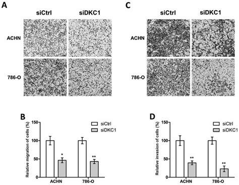 Knockdown Of DKC1 Inhibits The Migration And Invasion Of CcRCC Cells In